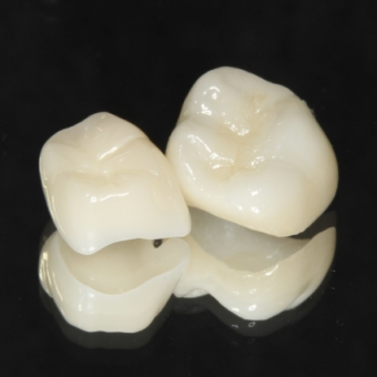 歯科用CADで作製した歯の詰め物