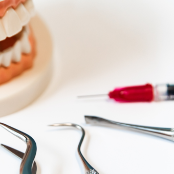 痛みを抑える歯科用医療器具の数々